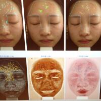有人做過(guò)光子嫩膚嗎？自己做過(guò)，感覺(jué)果不錯(cuò)分享