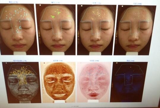 有人做過光子嫩膚嗎？自己做過，感覺果不錯分享