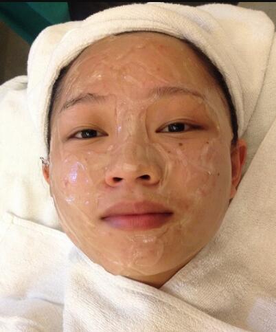 有人做過光子嫩膚嗎？自己做過，感覺果不錯分享