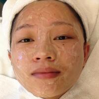 有人做過(guò)光子嫩膚嗎？自己做過(guò)，感覺(jué)果不錯(cuò)分享