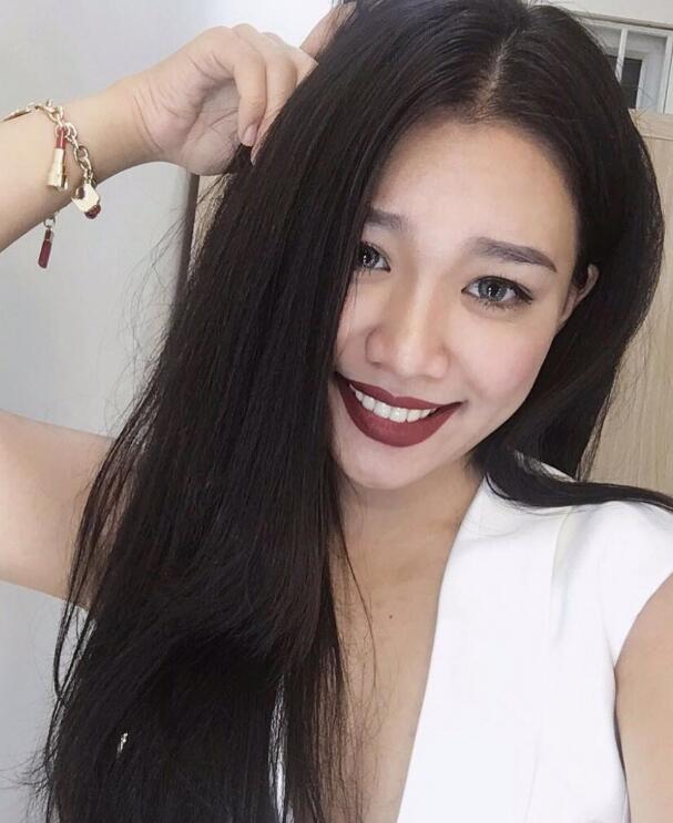 玻尿酸去法令紋前后對比圖分享