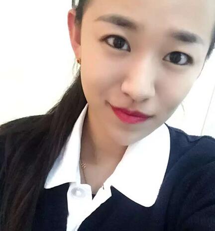 注射瘦臉去抬頭紋眉間紋恢復(fù)過(guò)程圖，真實(shí)案例分享