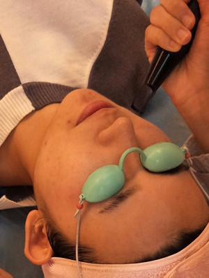 濰坊華美任傳琦醫(yī)生做的水氧嫩膚前后對比照片分享