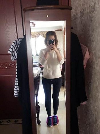 廣州美萊羅延平做的大腿環(huán)吸整形恢復(fù)果過程案例