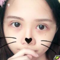 切開雙眼皮+開眼角前后對比圖和恢復過程分享