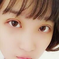 切開雙眼皮多少錢？割雙眼皮真實案例多對比圖分享