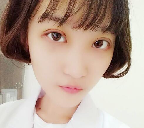 切開(kāi)雙眼皮多少錢(qián)?割雙眼皮真實(shí)案例多對(duì)比圖分享