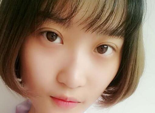 切開(kāi)雙眼皮多少錢(qián)?割雙眼皮真實(shí)案例多對(duì)比圖分享