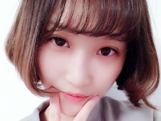 切開(kāi)雙眼皮多少錢(qián)?割雙眼皮真實(shí)案例多對(duì)比圖分享