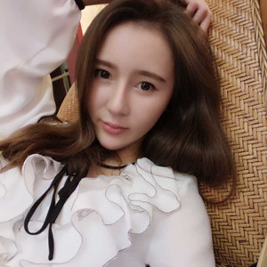 濟南海峽趙廣生做的自體耳軟骨墊鼻尖+硅膠隆鼻前后對比照片分享