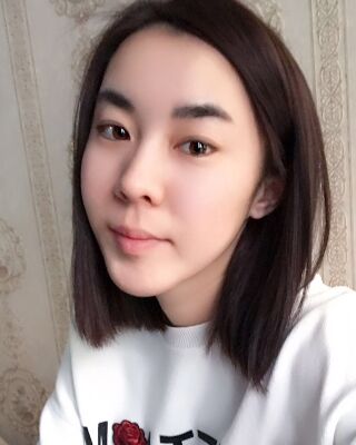 自體脂肪面部填充三個月果圖分享，減齡十歲