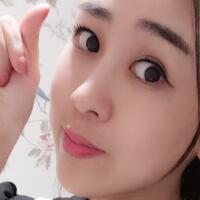 鼻翼縮小手術(shù)對比圖分享——四川悅好整形