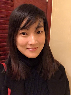 濟(jì)南愛容路傳燕醫(yī)生做的激光去黃褐斑，大家快來看看果如何