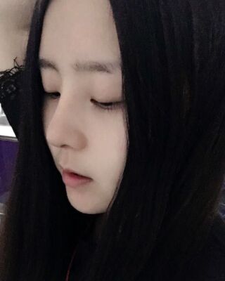 洛陽維多利亞隆鼻整形前后對比果圖