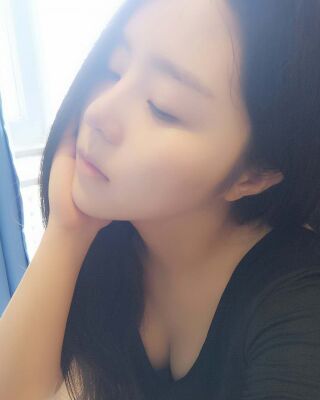 洛陽維多利亞隆鼻整形前后對比果圖