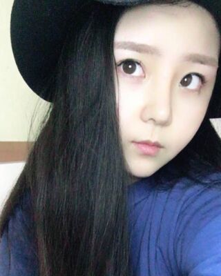 洛陽維多利亞隆鼻整形前后對比果圖