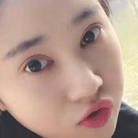 開眼角+割雙眼皮真實(shí)案例前后對比圖分享——四川悅好整形