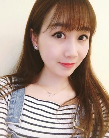 上海九院林曉曦割雙眼皮半年了