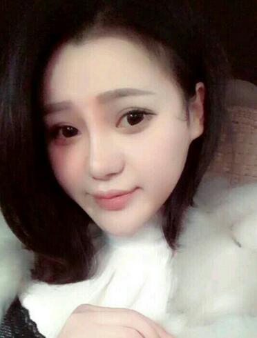 上海九院李圣利隆鼻整形真實恢復(fù)期圖片