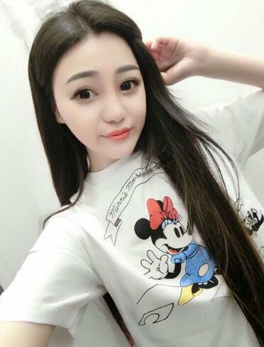 上海九院李圣利隆鼻整形真實恢復(fù)期圖片