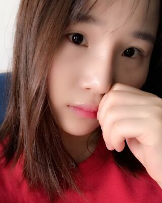 仇侃敏韓式隆鼻整形恢復果對比照片