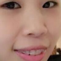 牙齒矯正的適宜年齡，多對比圖真實案例分享——成都格林口