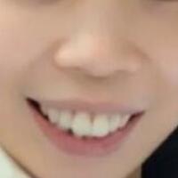 牙齒矯正的適宜年齡，多對比圖真實案例分享——成都格林口