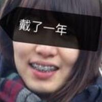 成都牙齒矯正前后對比圖分享——成都格林口腔