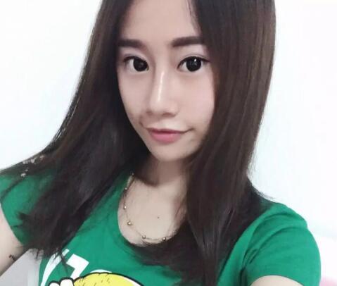 假體隆鼻恢復(fù)后果圖