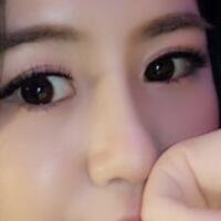 歪鼻子矯正整形恢復(fù)過程和對比圖分享——成都魅麗經(jīng)緯醫(yī)療