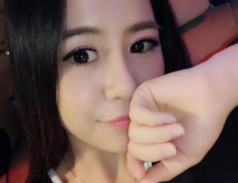 歪鼻子矯正整形恢復(fù)過(guò)程和對(duì)比圖分享——成都魅麗經(jīng)緯醫(yī)療