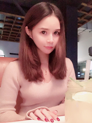 深圳南西子鄭舉衛(wèi)做的吸脂瘦臉，讓我基本擺脫嬰兒肥了