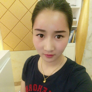 武漢美都張召醫(yī)生做的自體脂肪豐額頭+太陽穴，真實案例分享