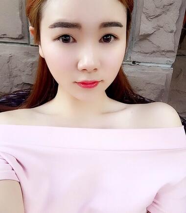 八大處楊明勇做的雙眼皮 半年了