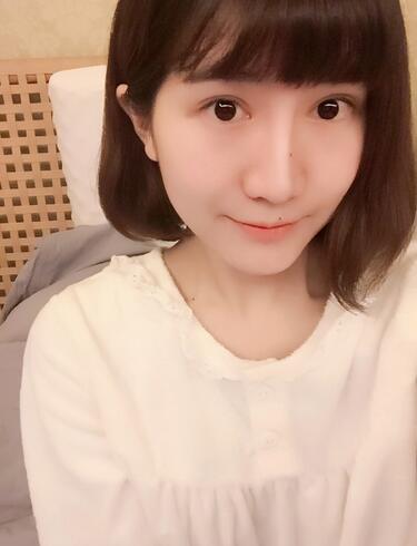 杭州王圣林全切雙眼皮恢復(fù)過(guò)程圖