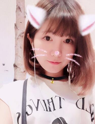 杭州王圣林全切雙眼皮恢復(fù)過(guò)程圖