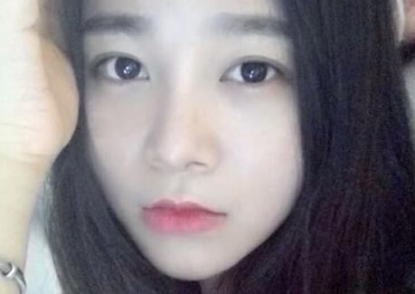 隆鼻整形價格和真實恢復期圖片