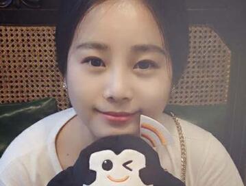 隆鼻整形價格和真實恢復期圖片