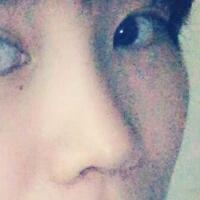 杭州悅可整形醫(yī)院做隆鼻失敗修復(fù)恢復(fù)過程和對(duì)比圖分享