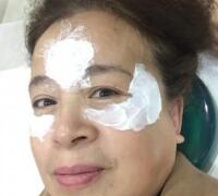 去抬頭紋方法？杭州悅可整容推薦注射瘦臉去抬頭紋魚(yú)尾紋