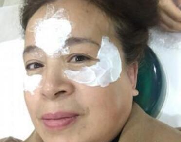 去抬頭紋很好的方法？注射瘦臉去抬頭紋魚尾紋