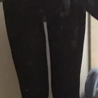 光纖溶脂瘦大腿有的方法真實案例分享——西安瑞麗整形