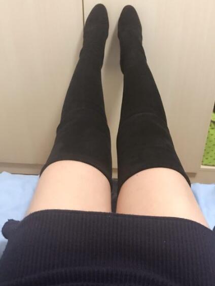 吸脂減肥瘦大腿前后對(duì)比圖，光纖溶脂瘦大腿較有的方法真實(shí)案例