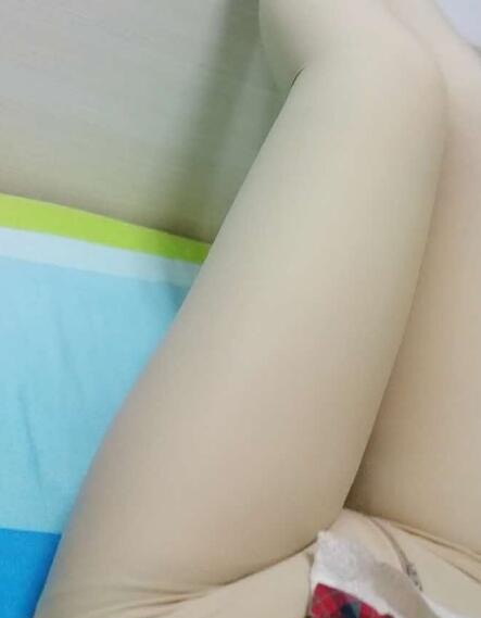 吸脂減肥瘦大腿前后對(duì)比圖，光纖溶脂瘦大腿較有的方法真實(shí)案例