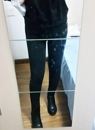 吸脂減肥瘦大腿前后對(duì)比圖，光纖溶脂瘦大腿較有的方法真實(shí)案例