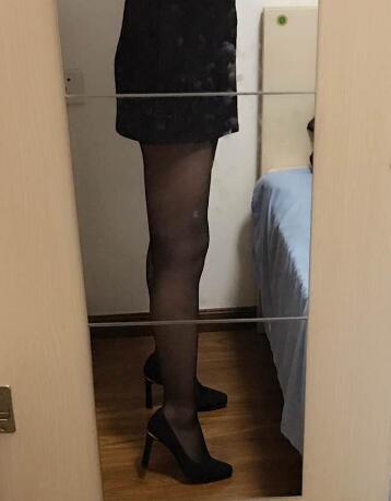 吸脂減肥瘦大腿前后對(duì)比圖，光纖溶脂瘦大腿較有的方法真實(shí)案例