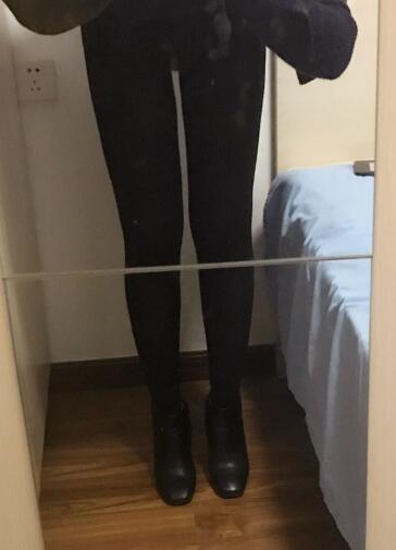 吸脂減肥瘦大腿前后對(duì)比圖，光纖溶脂瘦大腿較有的方法真實(shí)案例