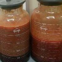 水動力吸脂瘦大腿真實案例多對比圖經歷——西安瑞麗整形