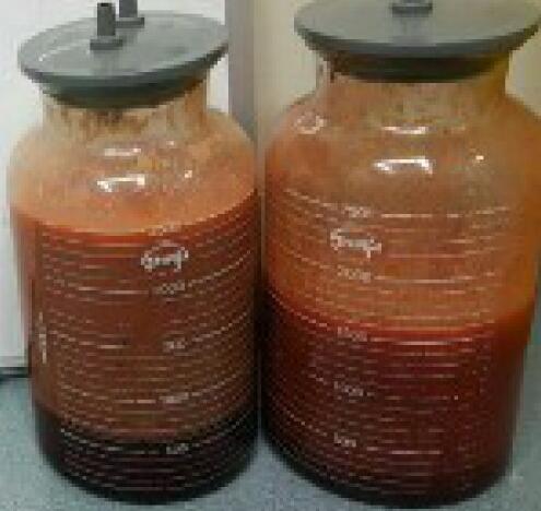 吸脂瘦大腿前后對比圖，水動力吸脂瘦大腿真實案例多對比圖經(jīng)歷