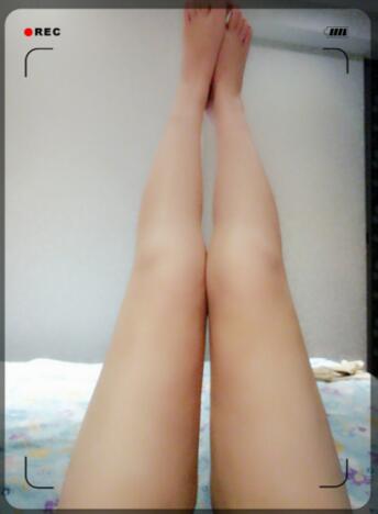 吸脂瘦大腿前后對比圖，水動力吸脂瘦大腿真實案例多對比圖經(jīng)歷